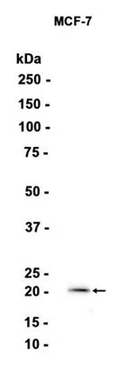GTPase HRAS Rabbit Monoclonal Antibody - Size: 100µl