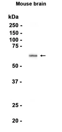 GAD67 Rabbit Monoclonal Antibody