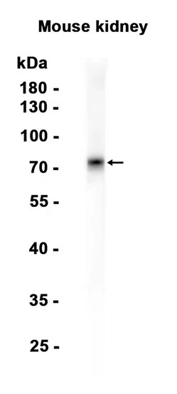 Netrin 1 Rabbit Monoclonal Antibody - Size: 50µl