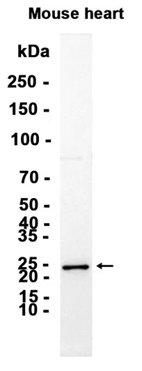 Hsp22 Rabbit Monoclonal Antibody - Size: 50µl