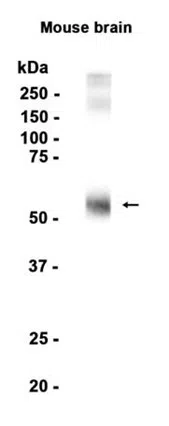 EAAT1 Rabbit Monoclonal Antibody - Size: 50µl