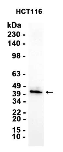 Delta Opioid Receptor Rabbit Monoclonal Antibody - Size: 50µl
