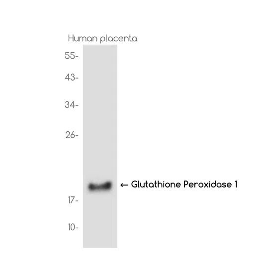 Glutathione Peroxidase 1 Rabbit Monoclonal Antibody - Size: 50µl