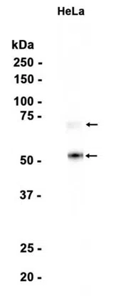 Heparanase 1 Rabbit Monoclonal Antibody - Size: 100µl