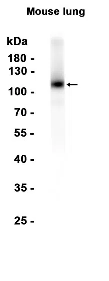 Thrombomodulin Rabbit Monoclonal Antibody