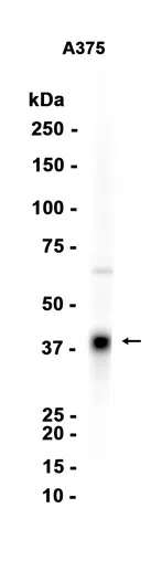 SPARC Rabbit Monoclonal Antibody - Size: 100µl
