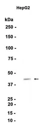 WISP3 Rabbit Monoclonal Antibody - Size: 100µl