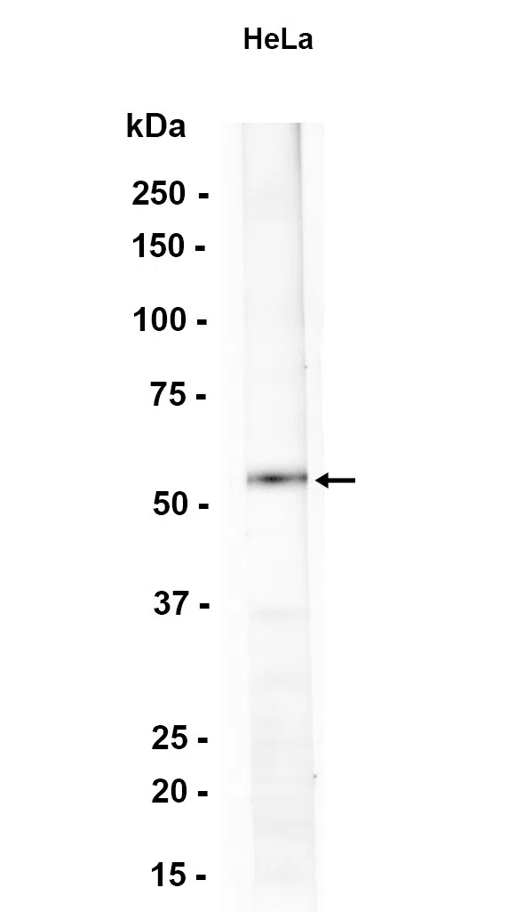 PTEN Rabbit Monoclonal Antibody - Size: 50µl