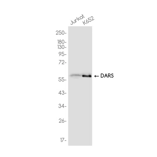 DARS Rabbit Monoclonal Antibody - Size: 50µl
