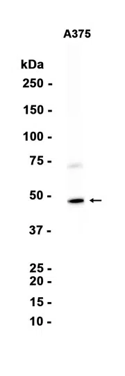 Carbonic Anhydrase XIV Rabbit Monoclonal Antibody - Size: 50µl