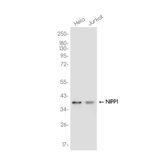 NIPP1 Rabbit Monoclonal Antibody - Size: 50µl