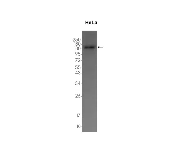 VPS11 Rabbit Monoclonal Antibody