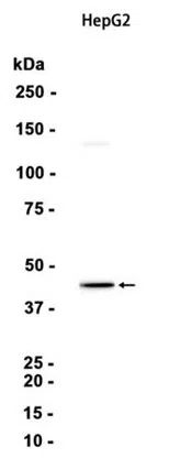 GCDH Rabbit Monoclonal Antibody - Size: 50µl