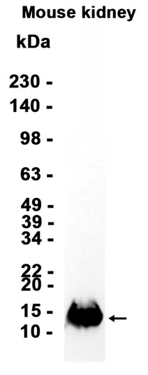MEF2BNB Rabbit Monoclonal Antibody - Size: 100µl