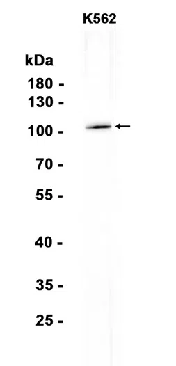 UBE3A Rabbit Monoclonal Antibody - Size: 100µl