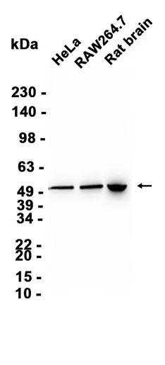 beta I Tubulin Rabbit Monoclonal Antibody - Size: 100µl