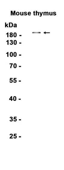 DEC-205 Rabbit Monoclonal Antibody - Size: 50µl