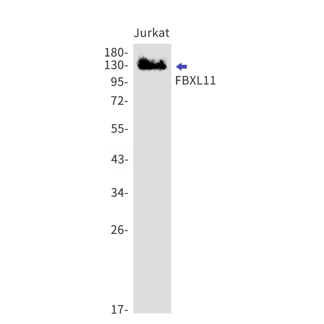 FBXL11 Rabbit Monoclonal Antibody - Size: 100µl