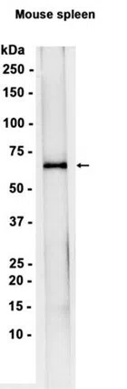 TGFBI Rabbit Monoclonal Antibody - Size: 50µl