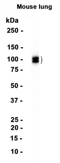 CD31 Rabbit Monoclonal Antibody
