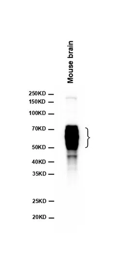 Phospho-Tau (Thr205) Rabbit Monoclonal Antibody - Size: 100µl