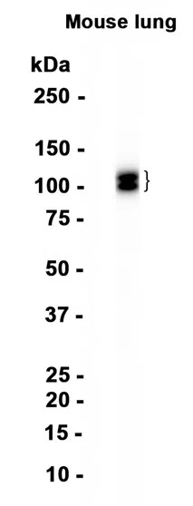 CD31 Rabbit Monoclonal Antibody - Size: 100µl