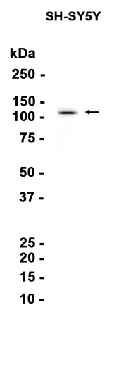 SNF2L Rabbit Monoclonal Antibody