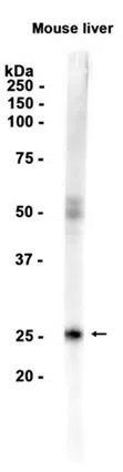 Mannan Binding Lectin Rabbit Monoclonal Antibody