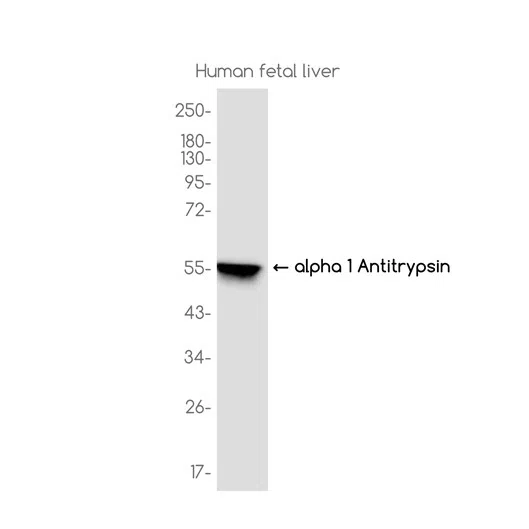 alpha 1 Antitrypsin Rabbit Monoclonal Antibody