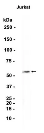 PPAR delta Rabbit Monoclonal Antibody - Size: 100µl