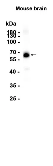 SYT2 Rabbit Monoclonal Antibody - Size: 50µl