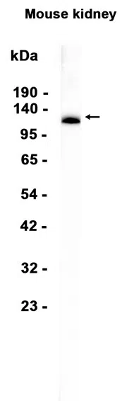 Cadherin 16 Rabbit Monoclonal Antibody - Size: 100µl