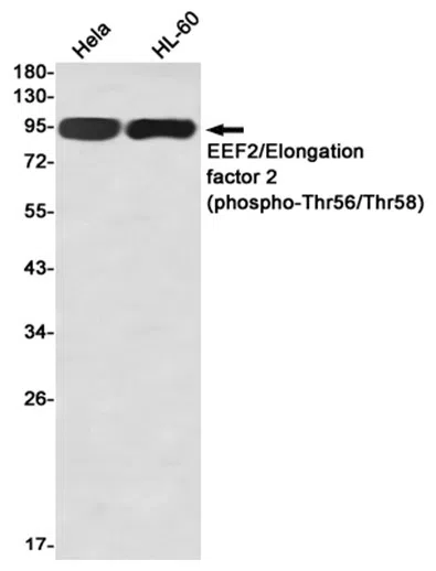 Phospho-EEF2 (Thr56/Thr58) Rabbit Monoclonal Antibody