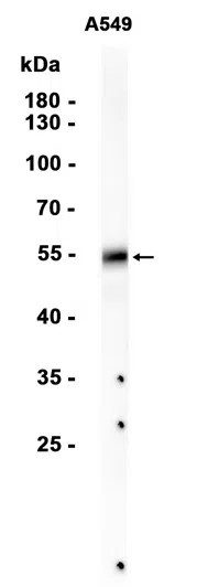 ALDH3A1 Rabbit Monoclonal Antibody - Size: 100µl