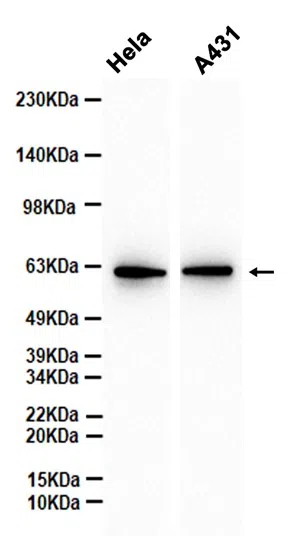 Silencer of Death Domain Rabbit Monoclonal Antibody - Size: 50µl
