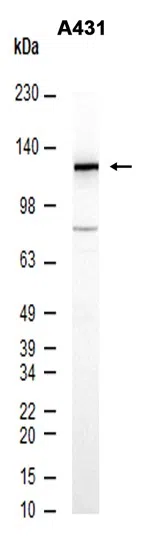 Phospho-SIRT1 (Thr530) Rabbit Monoclonal Antibody - Size: 50µl