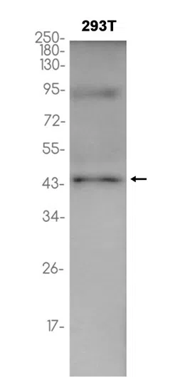 Phospho-Pyruvate Dehydrogenase E1-alpha subunit (DGR14223) Rabbit Monoclonal Antibody