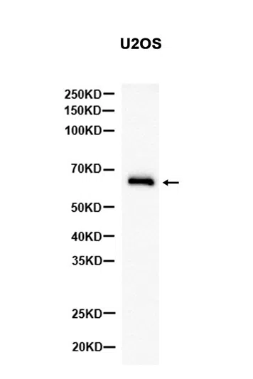 Phospho-AMPK alpha 1 (Thr183)/AMPK alpha 2 (Thr172) Rabbit Monoclonal An