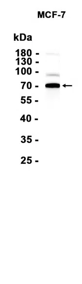 S6K1 Rabbit Monoclonal Antibody - Size: 50µl