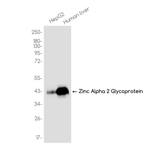 Zinc Alpha 2 Glycoprotein Rabbit Monoclonal Antibody - Size: 50µl