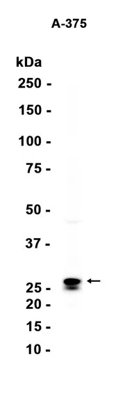 CTHRC1 Rabbit Monoclonal Antibody - Size: 100µl