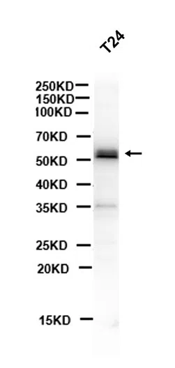 Phospho-Smad3 (Ser423/Ser425) Rabbit Monoclonal Antibody - Size: 100µl