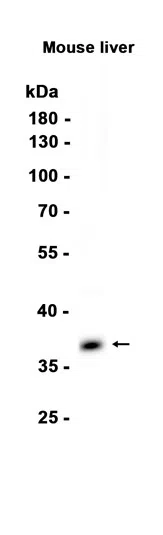 HSD11B1 Rabbit Monoclonal Antibody - Size: 100µl