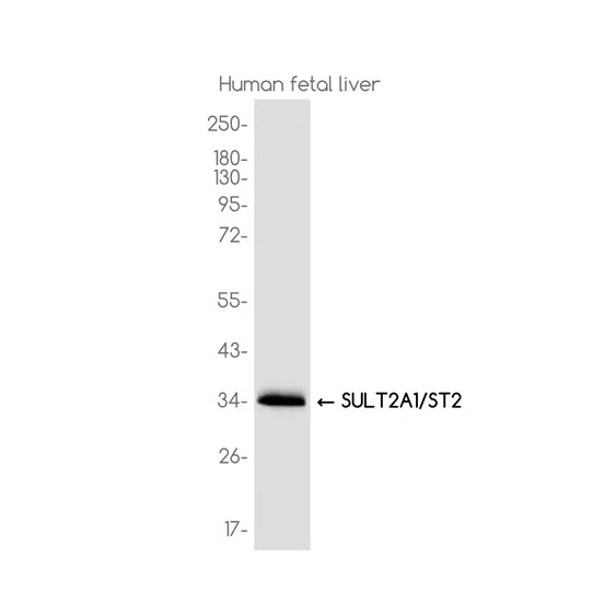 SULT2A1/ST2 Rabbit Monoclonal Antibody - Size: 50µl