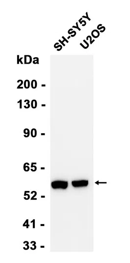 Calcineurin A Rabbit Monoclonal Antibody - Size: 100µl