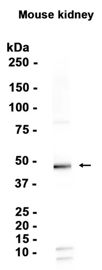 NPHS2 Rabbit Monoclonal Antibody - Size: 100µl