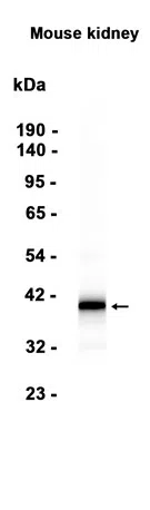 Arg2 Rabbit Monoclonal Antibody