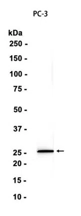 SRD5A2 Rabbit Monoclonal Antibody
