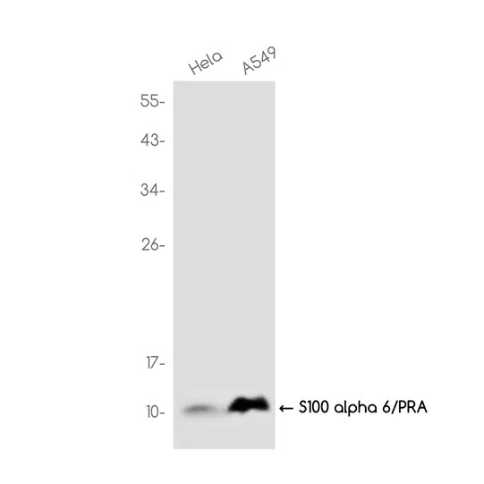 S100 alpha 6/PRA Rabbit Monoclonal Antibody - Size: 100µl