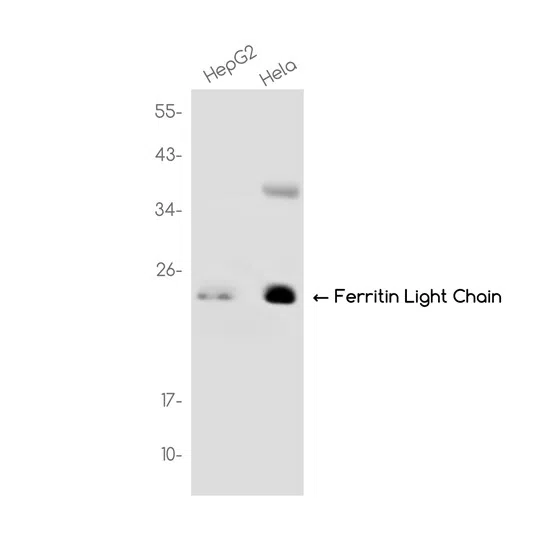 Ferritin Light Chain Rabbit Monoclonal Antibody - Size: 100µl
